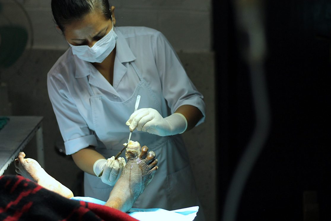 Zinggl_Reportage_WienerZeitung_Nepal_Lepra_Lalgadh_Leprosy_Clinic_03